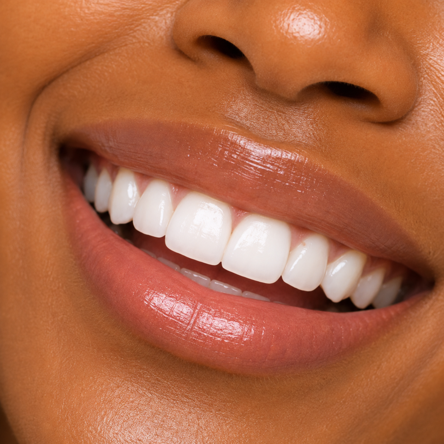 v34 Teeth Whitening Strips